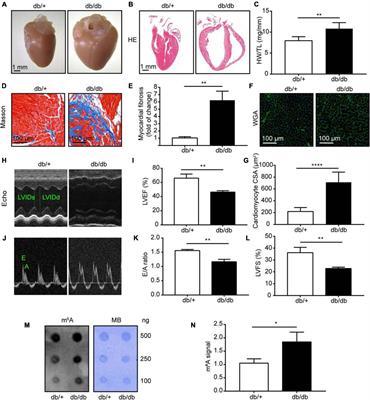 Changes in N6-Methyladenosine Modification Modulate Diabetic Cardiomyopathy by Reducing Myocardial Fibrosis and Myocyte Hypertrophy